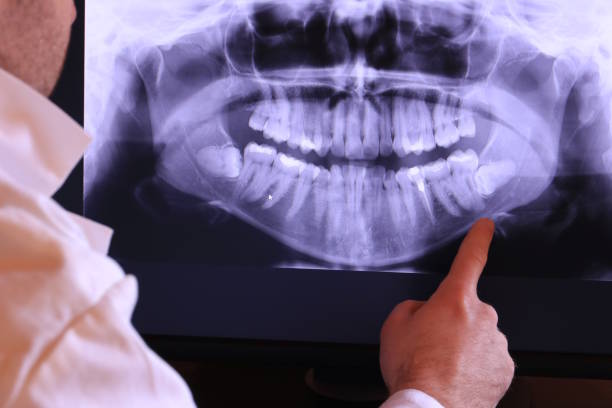 Best Emergency Tooth Extraction in Elm Springs, AR